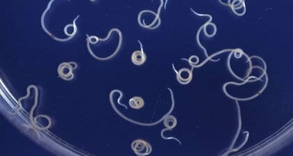 アニサキスはアレルギーにも？発症したら魚介は食べられない？日本では100人に1人の可能性…症状と対処法