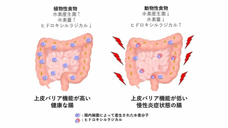 なぜ潰瘍性大腸炎は増え続けるのか？ ― 食生活の変化と腸内水素の減少に着目した新仮説 ―