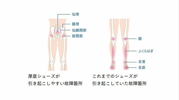 厚底シューズ時代とこれまでのシューズの故障箇所の変化(『厚底シューズ時代の新・体幹ランニング』より)