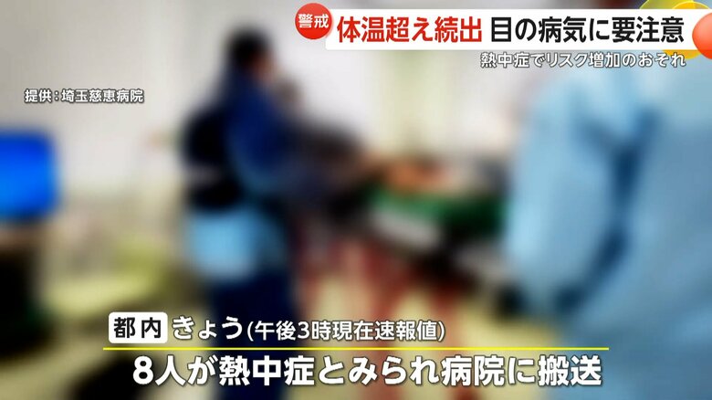 熱中症とみられる症状で病院に搬送された人（映像提供：埼玉慈恵病院）