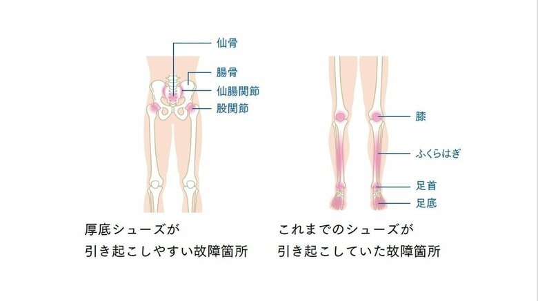 厚底シューズ時代とこれまでのシューズの故障箇所の変化（『厚底シューズ時代の新・体幹ランニング』より）