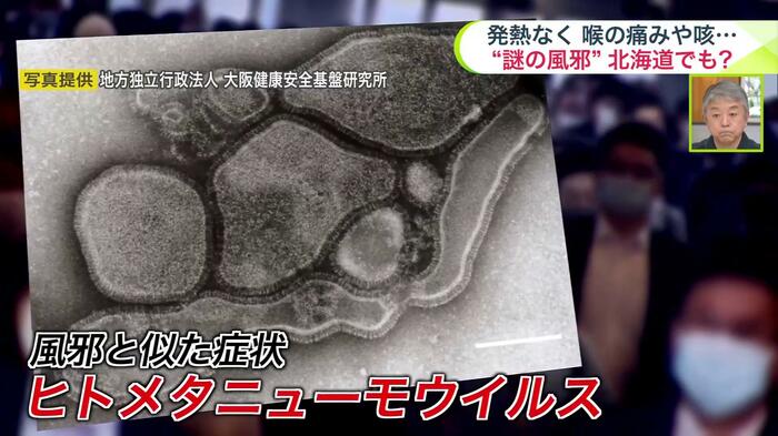 風邪のウイルスの一種「ヒトメタニューモウイルス」(提供:地方独立行政法人 大阪健康安全基盤研究所)