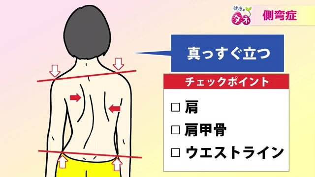 側弯症のチェック方法