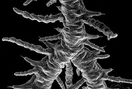 キングギドラシリスの体幹部は消化管・神経・筋肉なども含めて分岐が行われている（提供：東京大学大学院理学系研究科・附属臨海実験所の三浦徹教授）