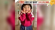 中間市の3歳息子“虐待死” 245カ所の傷痕 174カ所はタバコの火かスタンガンか 福岡県
