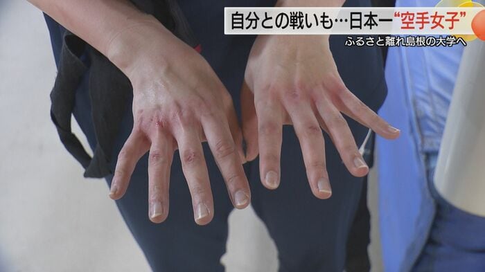 赤くすりむけた拳や指