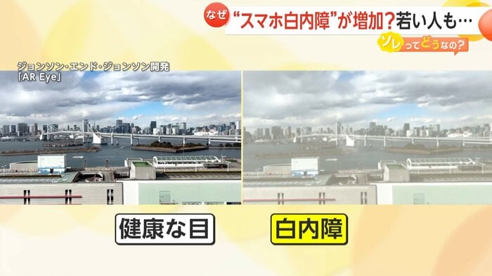 白内障の場合の見え方の違い