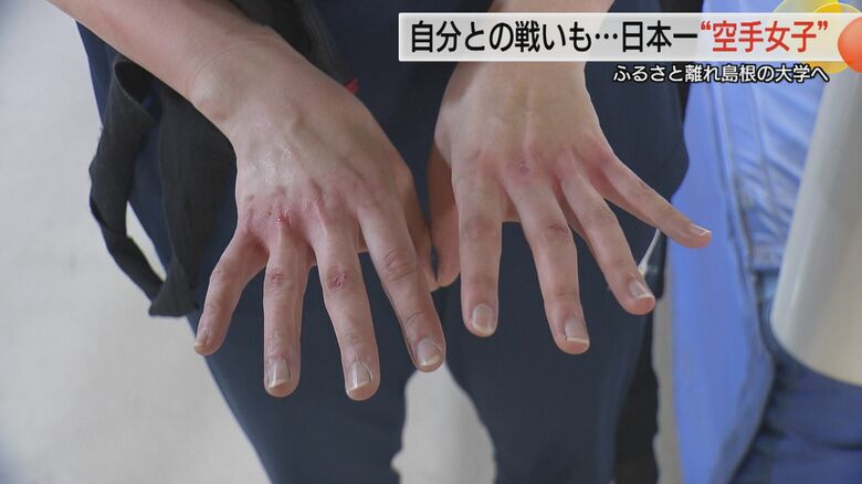 赤くすりむけた拳や指