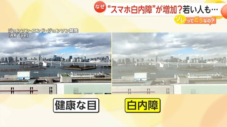 白内障の場合の見え方の違い