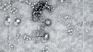 新型コロナ 東京都で新たに565人の感染確認