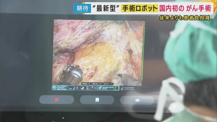 ダビンチ5による手術