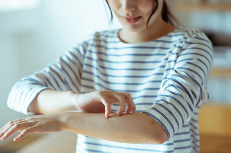 気になる虫刺されはダニのせい？（画像はイメージ）