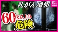 「閉経」と関係ない『乳がん』　60代以上の罹患率は20年前の2.5倍に急増　“誤った認識”で60代以上が検診受けず「後悔」語る女性も