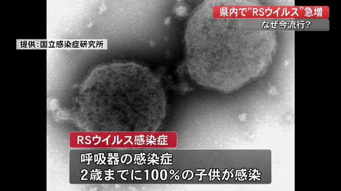 RSウイルス(提供:国立感染症研究所)