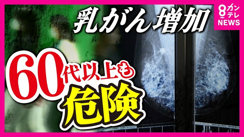 「閉経」と関係ない『乳がん』　60代以上の罹患率は20年前の2.5倍に急増　“誤った認識”で60代以上が検診受けず「後悔」語る女性も｜FNNプライムオンライン