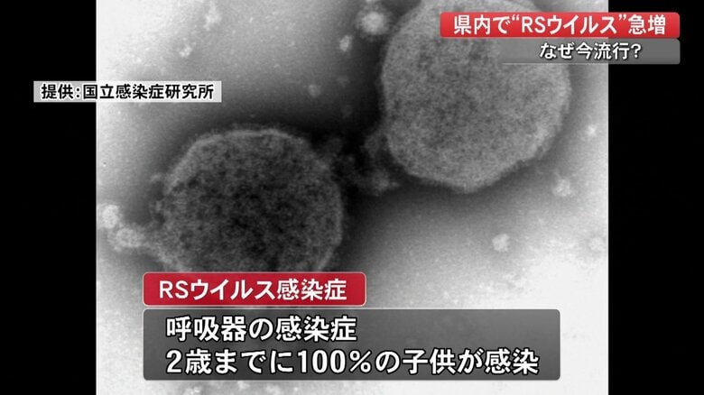 RSウイルス（提供：国立感染症研究所）