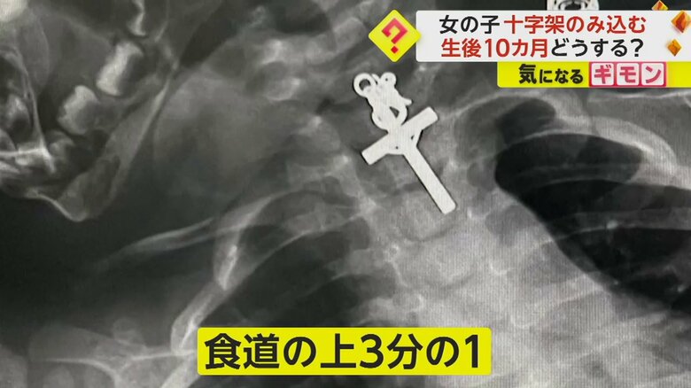 食道の上3分の1の辺りに詰まっていた十字架