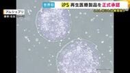 「患者の脳に移植・ドーパミン分泌量増やし運動機能改善」パーキンソン病の新治療法も「iPS細胞」を使用した再生医療製品が正式承認　世界初の実用化へ　早ければ年内に保険治療か