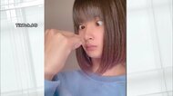 「最悪は手術が必要」…TikTokで話題の“寄り目