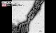 集団感染か…名寄保健所管内などで21人が体調不良訴え入院「レジオネラ菌」を患者から検出―21人のうち多くが名寄市周辺の施設を利用 感染源特定へ調査進める〈北海道〉