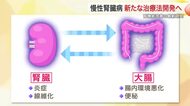 根本的な治療法は腎臓移植のみ…患者が増え続ける慢性腎臓病　東北大学の研究グループが腎機能改善の研究