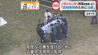 独自 全身やけど痕の京アニ事件青葉容疑者 医療チーム 真相解明のために治療