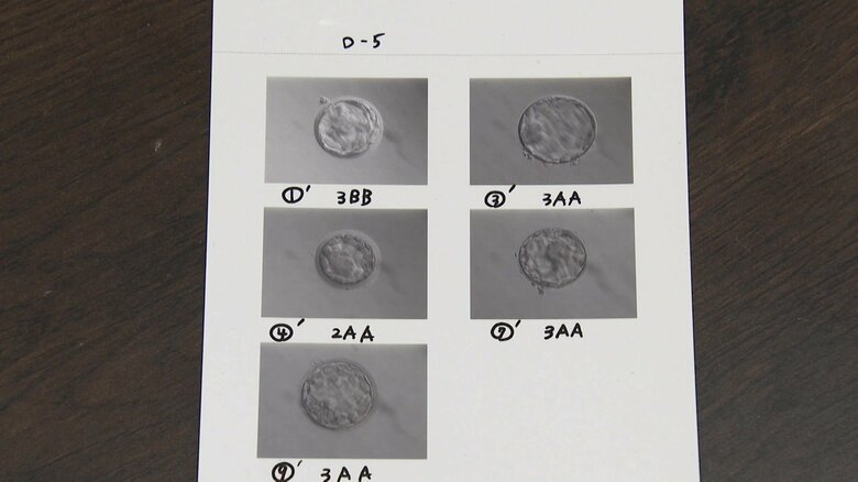 夫婦に残された5つの受精卵