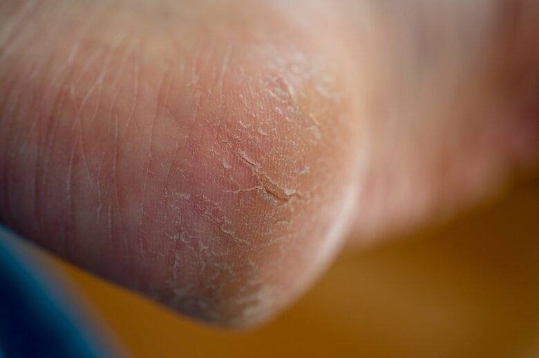 ひび割れたら要注意（画像はイメージ）