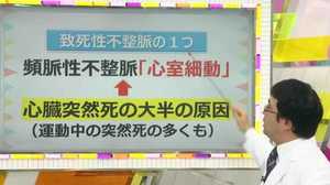 「私立恵比寿中学」松野莉奈さん急死の原因か。「致死性不整脈」による突然死を防ぐ