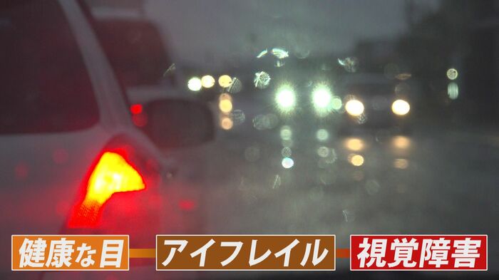 アイフレイルとは…