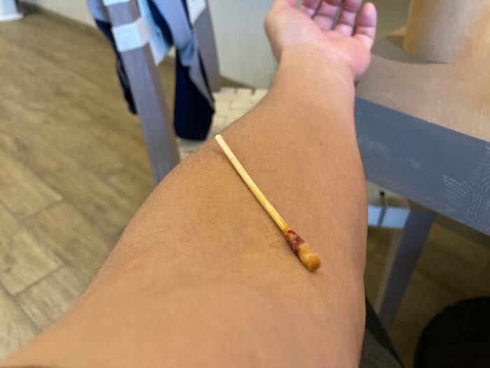採血後の止血は綿棒のみ