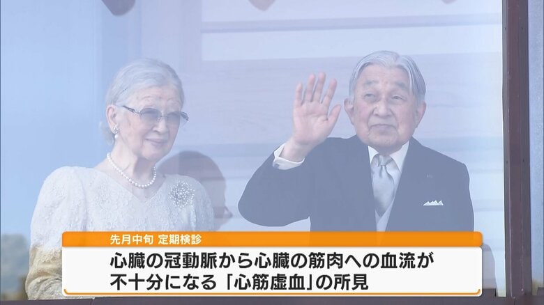 【宮内庁発表】上皇さま東京大学医学部附属病院に検査入院へ 定期検診で「心筋虚血」の所見  高齢の場合は“自覚症状なし”も｜FNNプライムオンライン