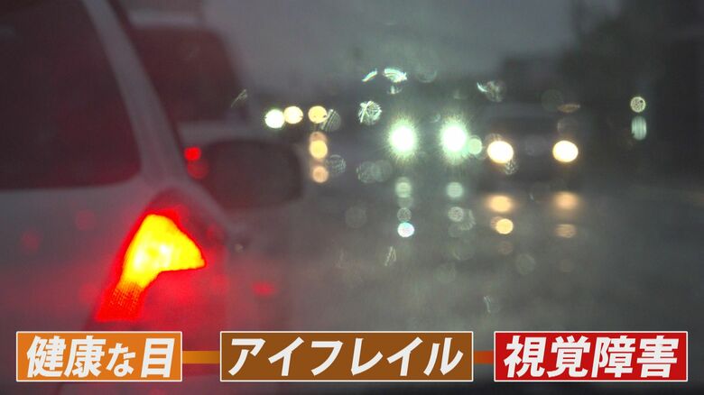 アイフレイルとは…