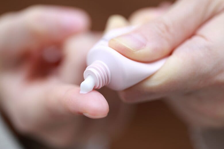 まずはステロイドの塗り薬で応急処置を、と室田さん（画像はイメージ）