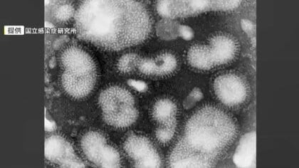 福岡県内のインフルエンザ感染者が増加　1医療機関あたり3.93人　前週の1.45倍に　リンゴ病は24週連続で「警報レベル」