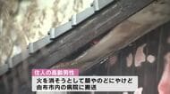 住宅全焼　１人暮らしの高齢男性が顔などにやけど　大分
