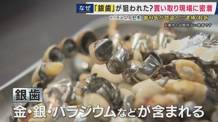 回収された銀歯