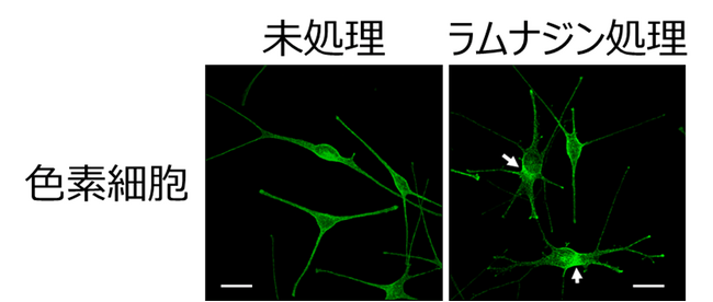 図２. メラノソームの輸送阻害を起こした細胞