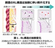 皮下深部の「Retaining Ligament(RL)」がたるみと関連