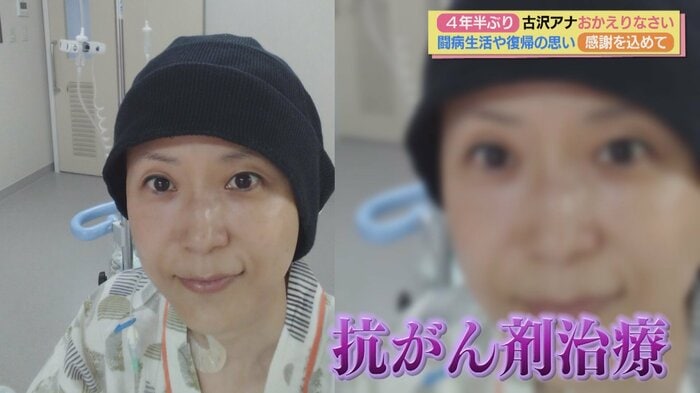 抗がん剤治療を受けていたころの古沢アナ