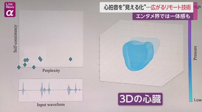3Dの心臓