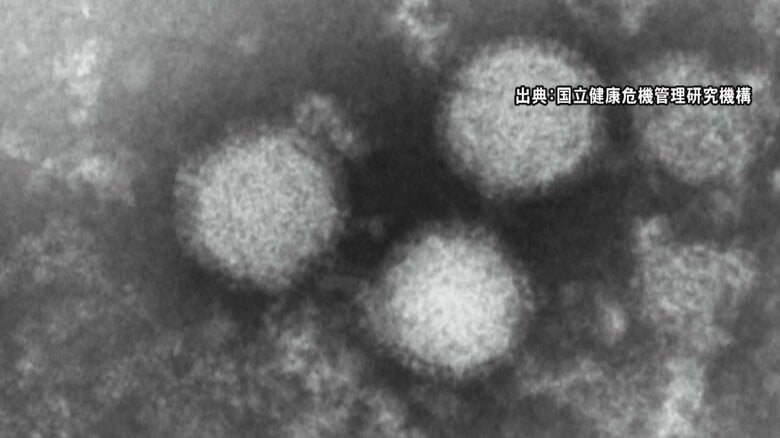 草刈り後に腕の“マダニ”に気づく…感染症『SFTS』岐阜で初の患者確認 女性が発熱など訴え複数の病院を受診し判明｜FNNプライムオンライン