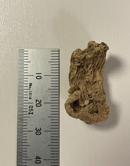 発見時の大きさは3cmほど