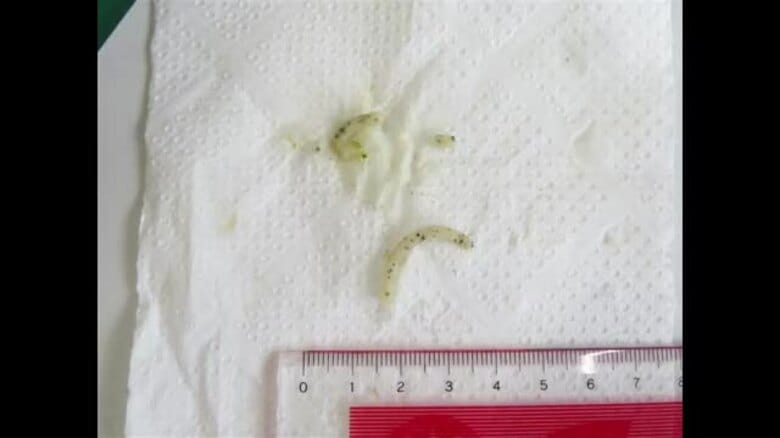 小学校の給食にカビ？混入　「担々麺」に黒い粒状の異物　健康被害の報告なし【長崎市】｜FNNプライムオンライン