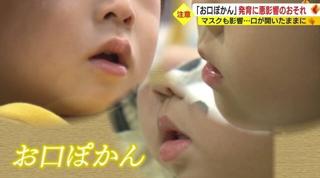 気になったらかかりつけの歯科医に相談を