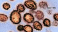 全国でこれまでに877人感染確認 6日連続 重症者400人台