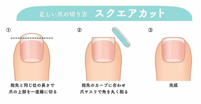切り方を変えるだけで爪トラブルの心配は軽減（イメージ）