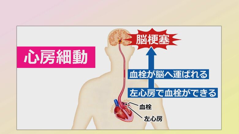 警戒が必要な心房細動