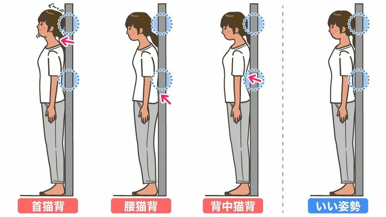 あなたは○○猫背？壁を使ったセルフチェック（イラスト＝さいとうひさし）