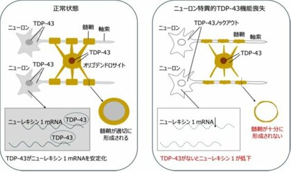 【摂南大学】ALSの原因タンパク質TDP-43の新たな機能を発見